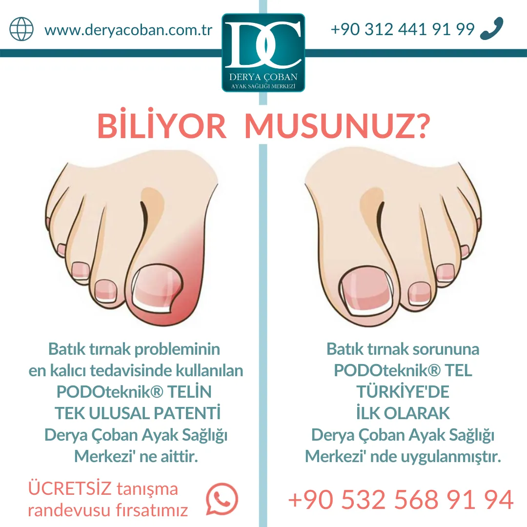 Batık Tırnak Probleminize Uygun Bir Çözüm