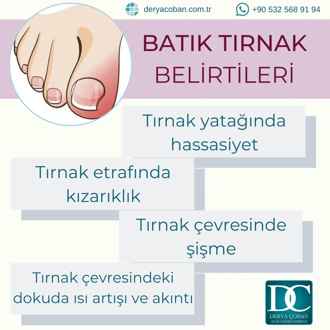 Tırnak Batması Hakkında Neler Biliyoruz?