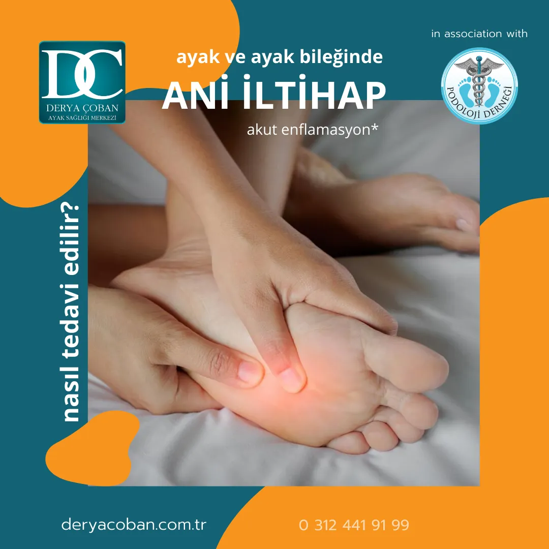 Ayak Bileğinde Ani İltihap