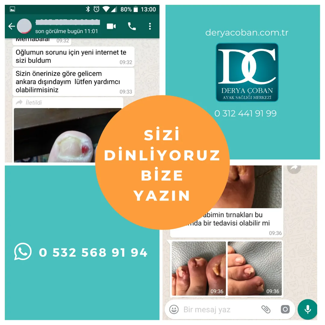 Derya Çoban Ayak Sağlığı WhatsApp hattı