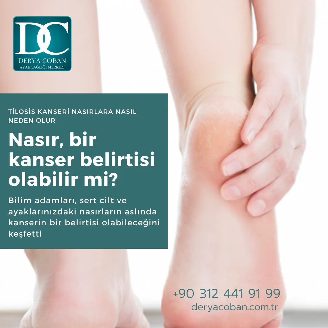 Nasır Kanser Belirtisi Mi?