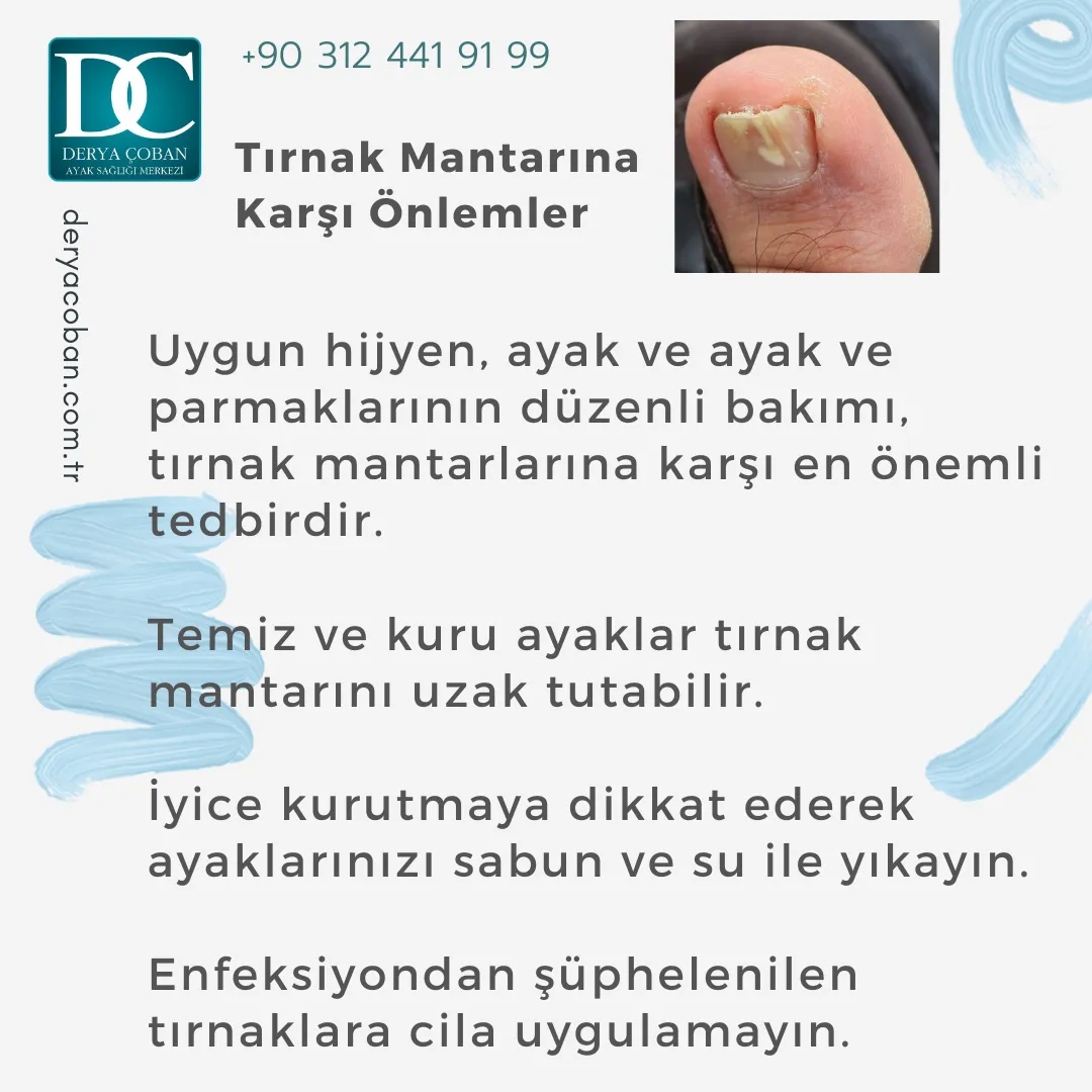 Tırnak Mantarı Nedir? Nasıl Tedavi Edilir? Nasıl Önlenir?