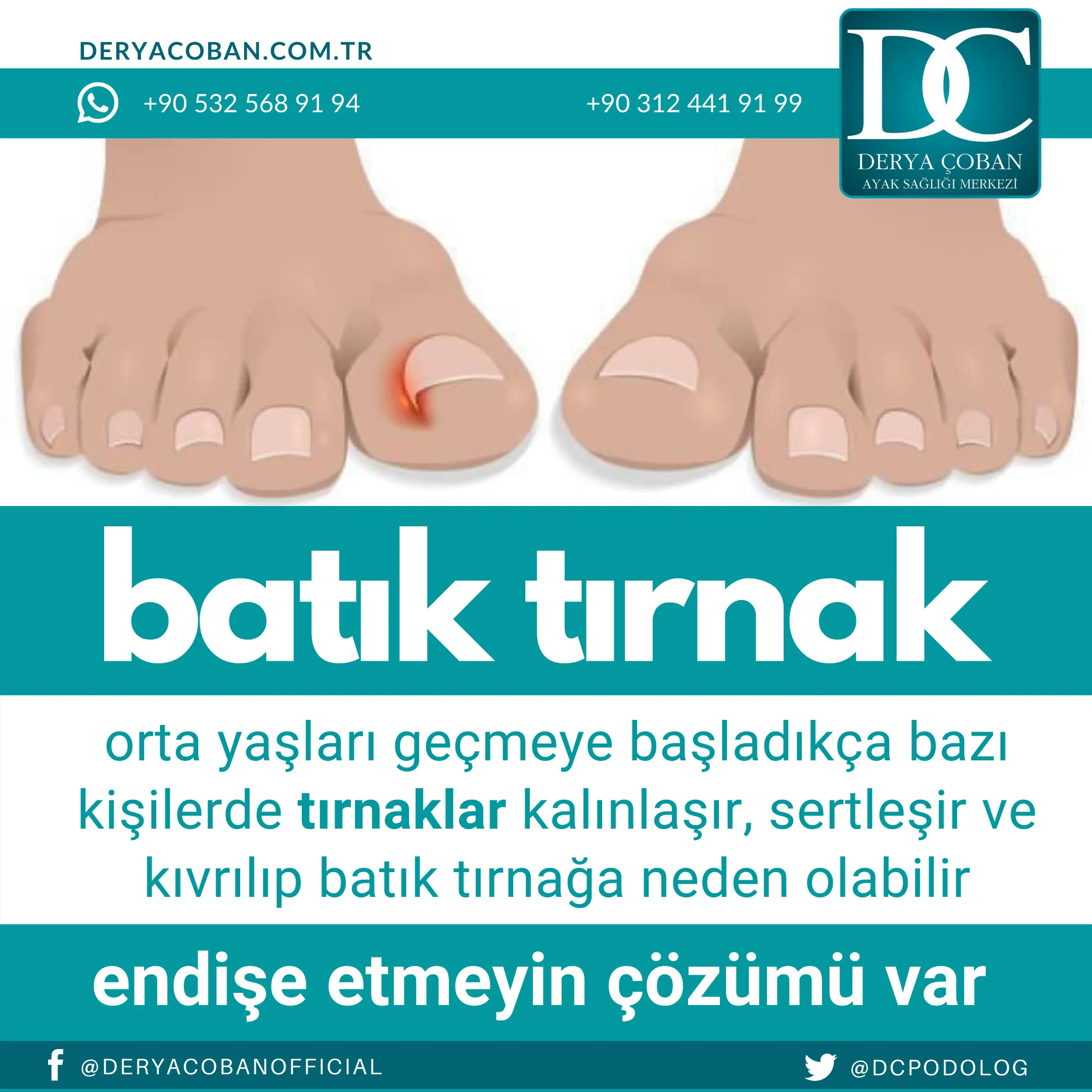 Batık Tırnak Neden Oluşur?