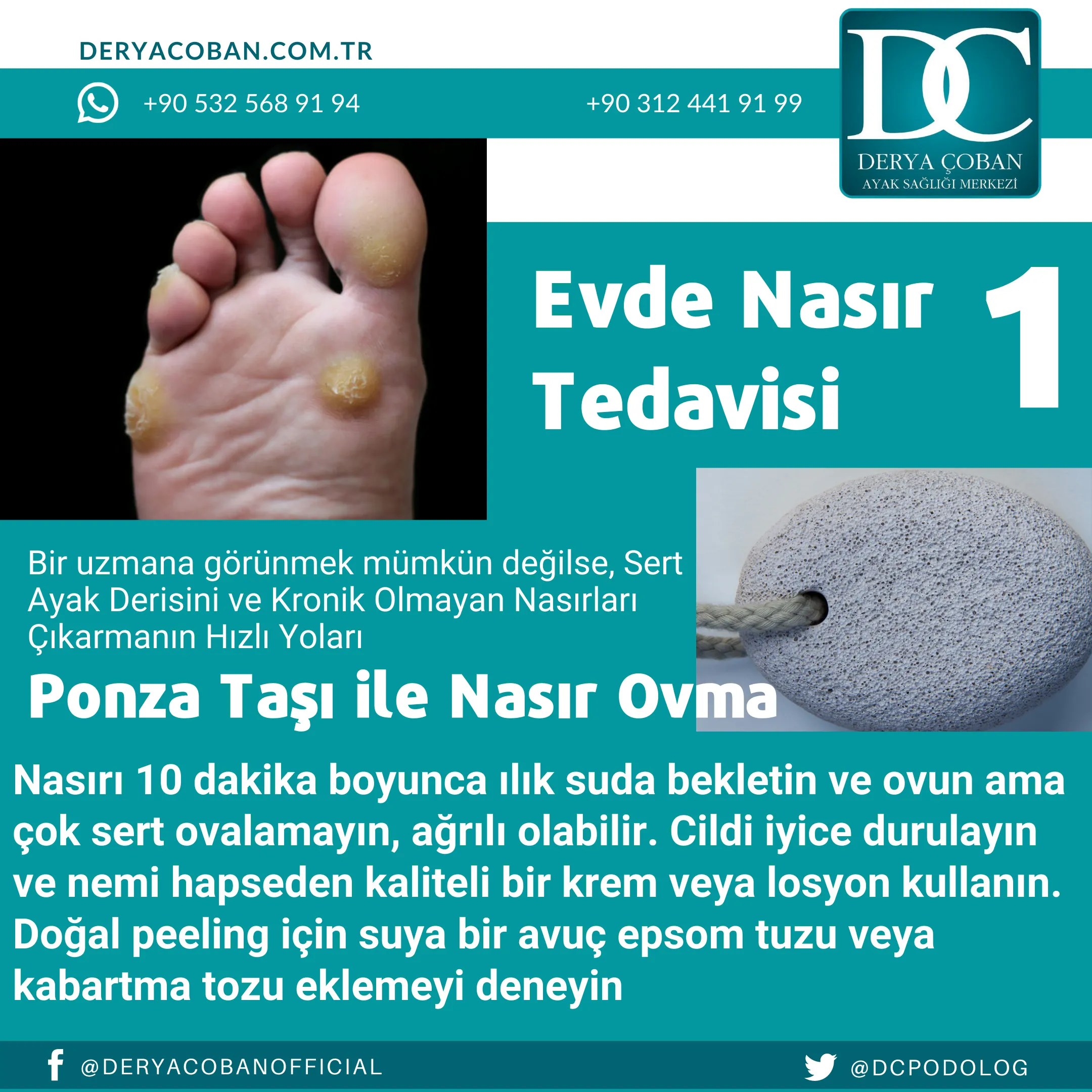 Evde Nasır Tedavisi