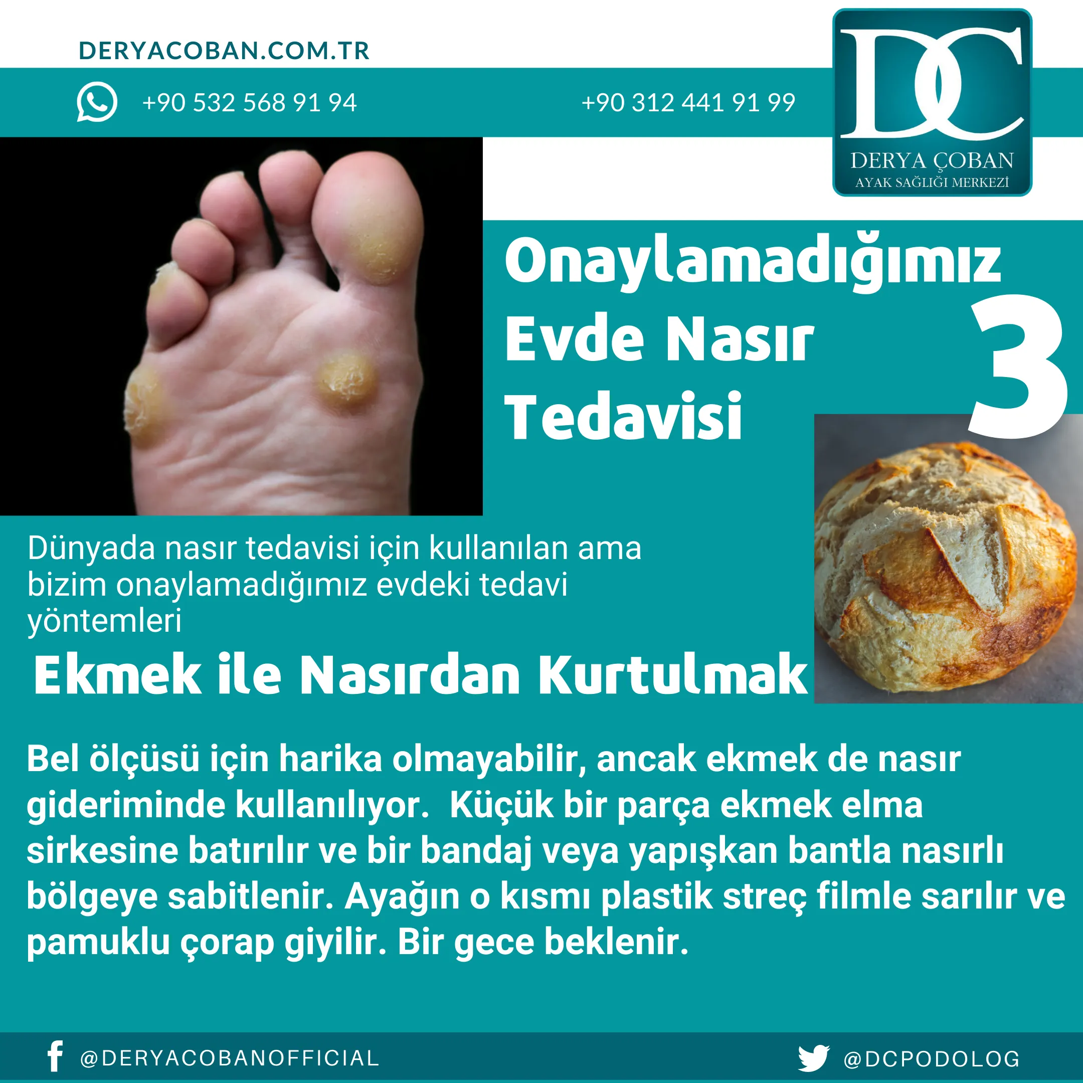 Nasır için Uzak Durulması Gerekenler