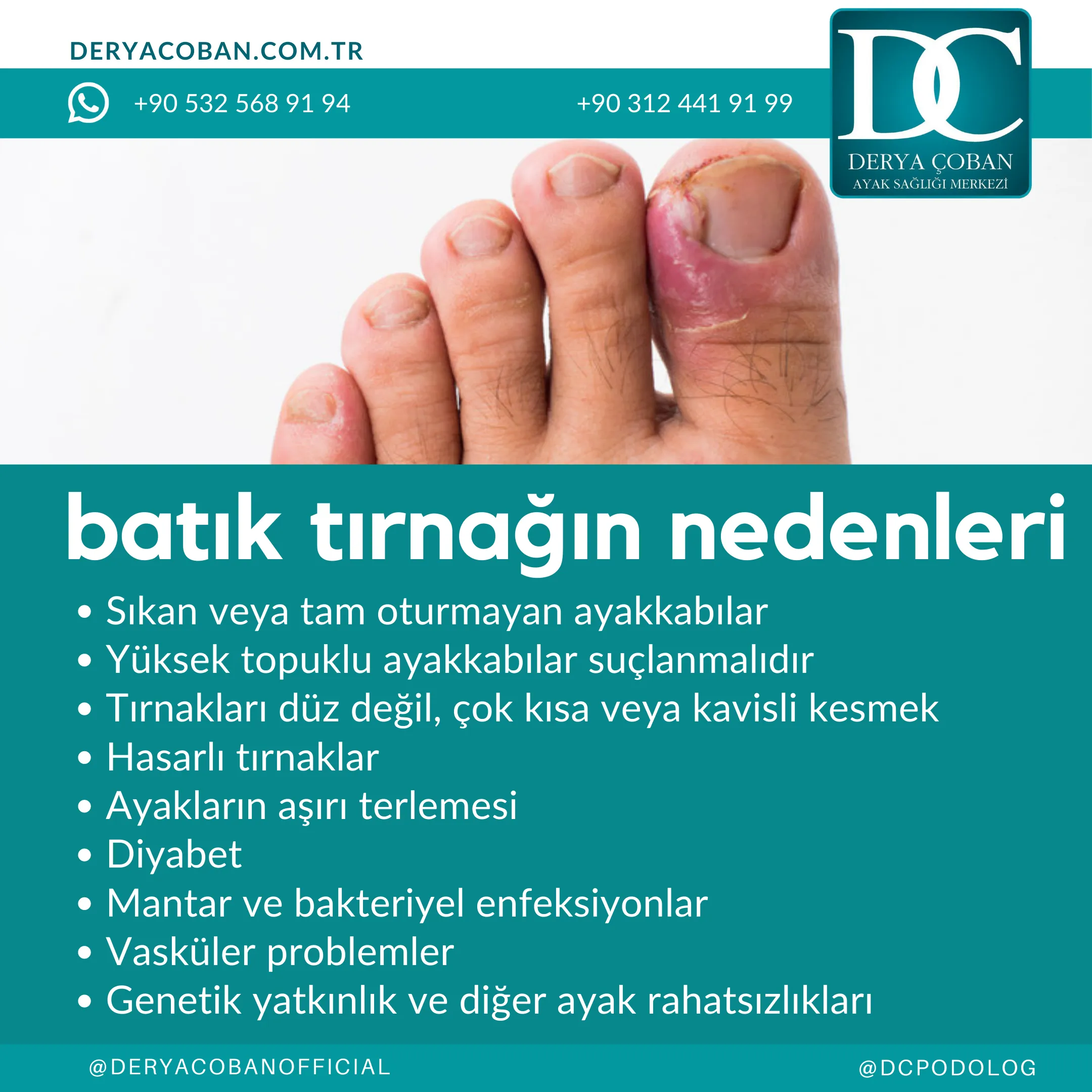 Batık Tırnağın Nedenleri