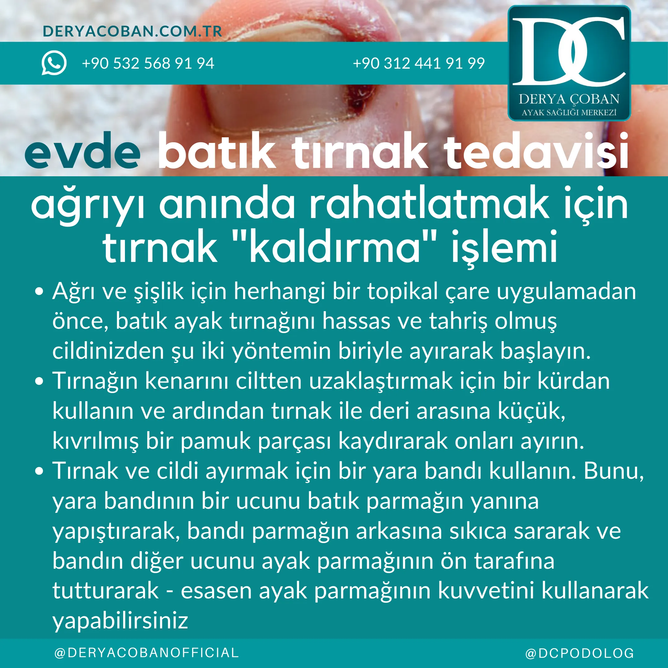 Evde Batık Tırnak Tedavisi