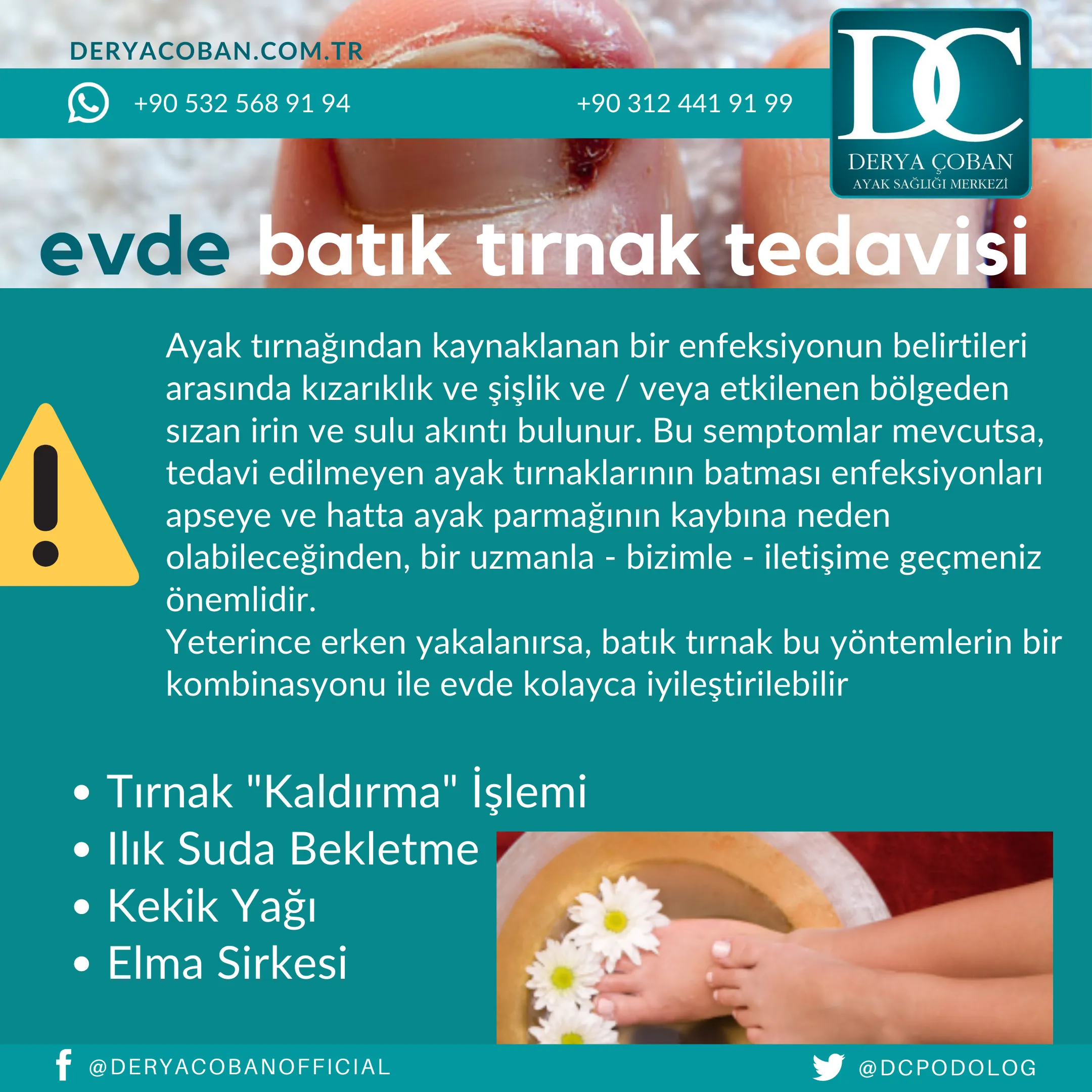 Evde Batık Tırnak Tedavisi