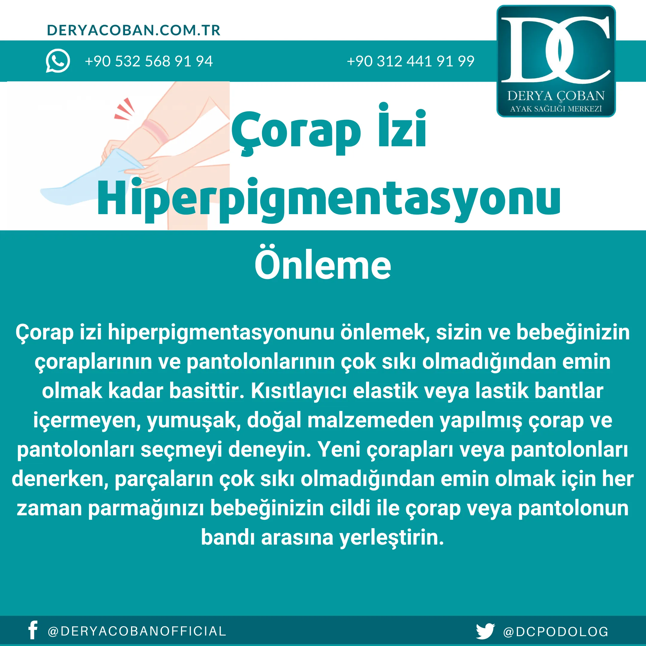 Çorap İzi Nasıl Geçer? Çorap İzi Hiperpigmentasyonu