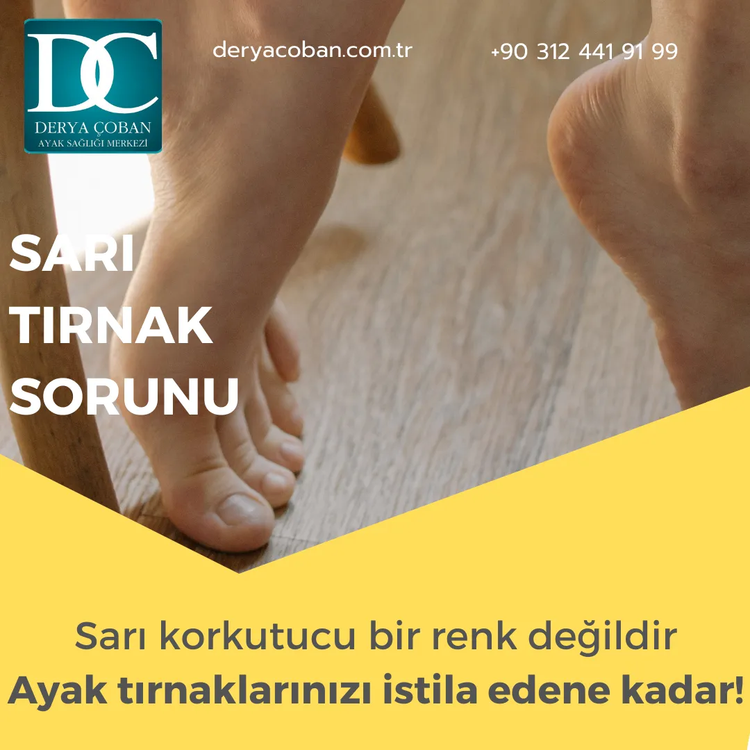 Tırnak Neden Sararır?