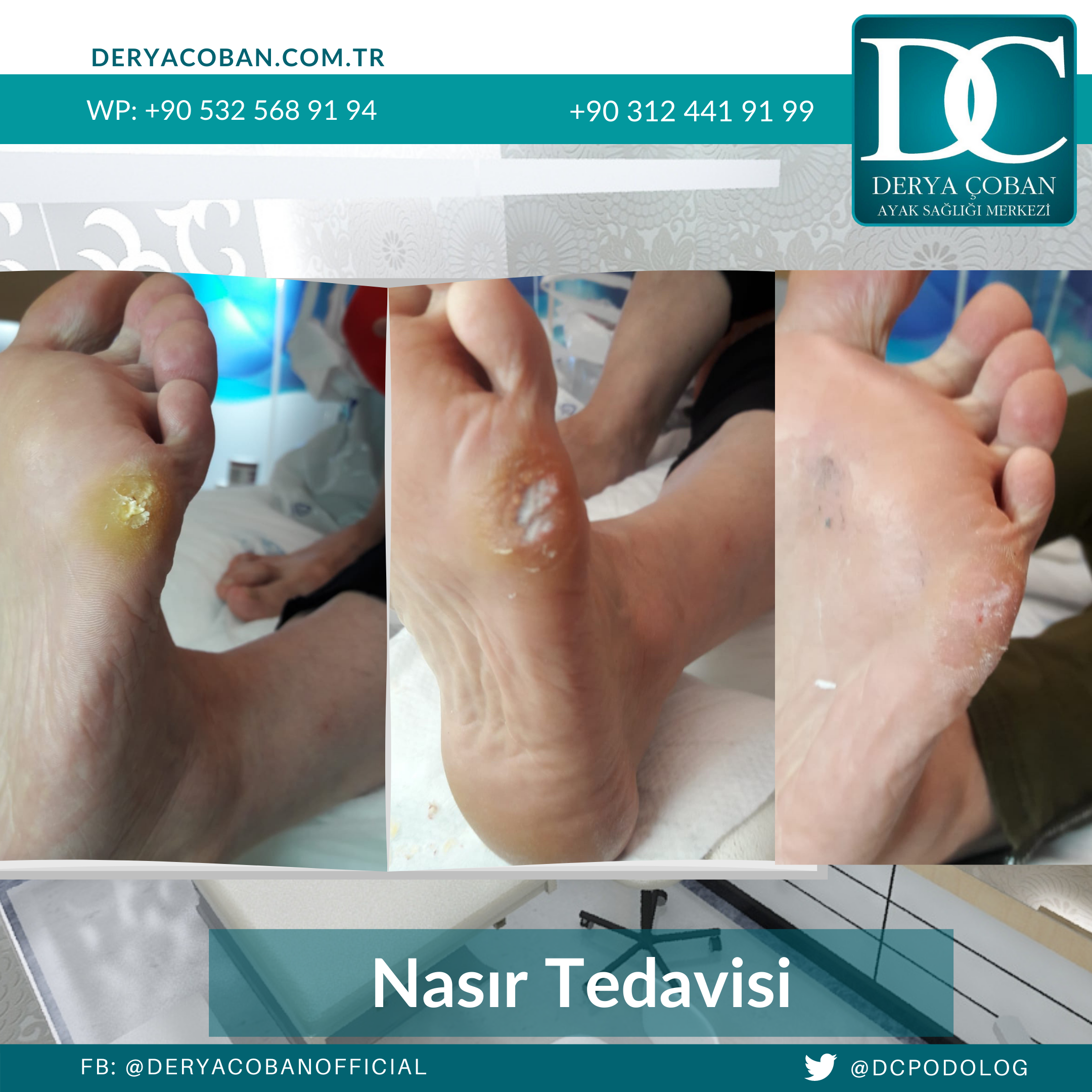 ayak hastalığı tedavileri