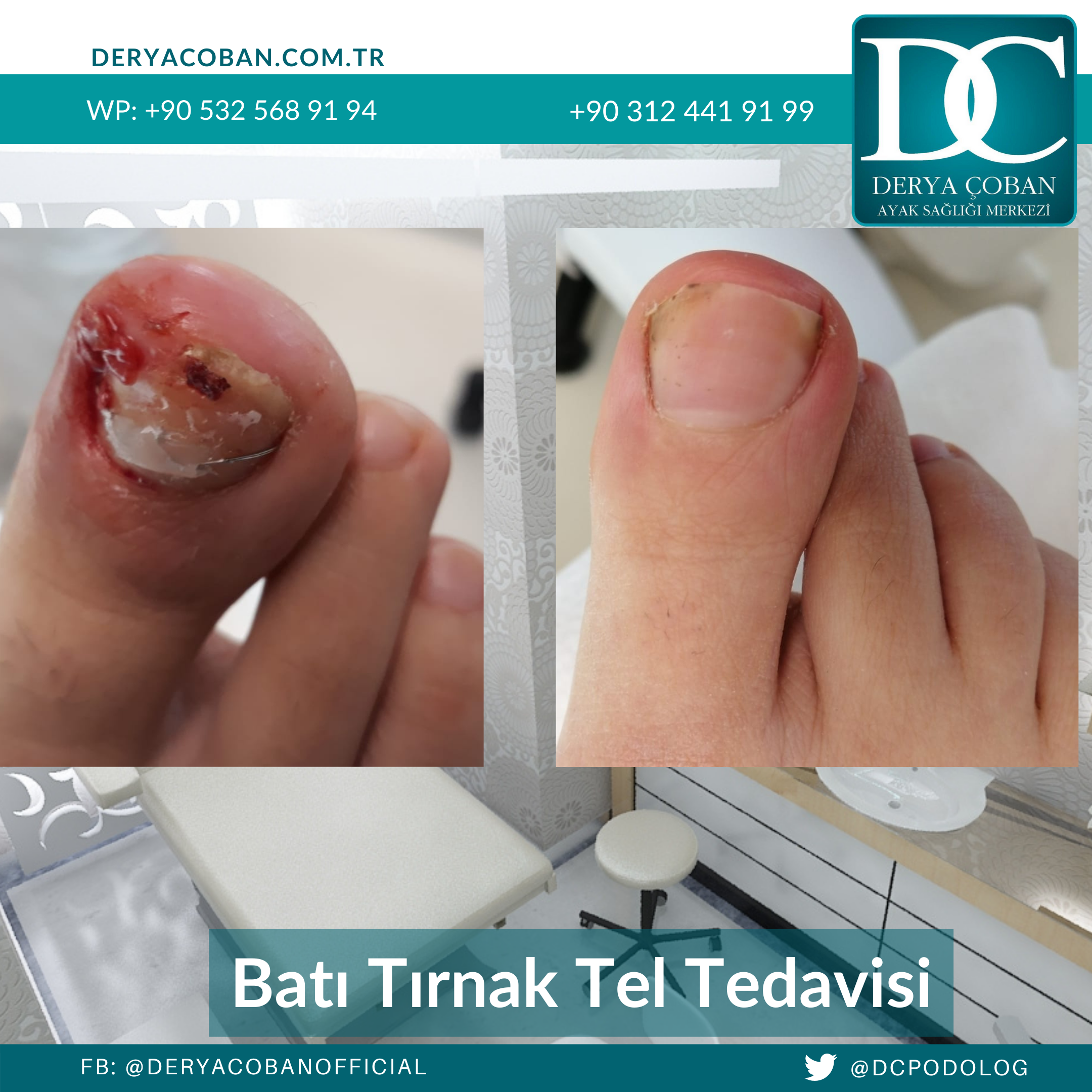 ayak hastalığı tedavileri